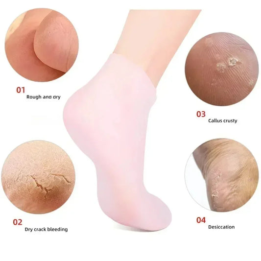 SILICON SOCKS