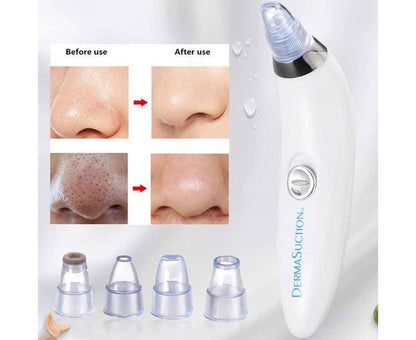 Black Head Remover Vacuum Suction Tool