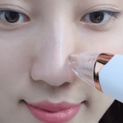 Black Head Remover Vacuum Suction Tool